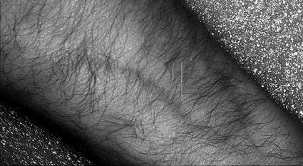 The light weight VEC03 vein finding device can let vein viewing through Hair